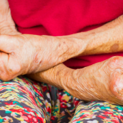 Avanços e Desafios na Política de Reparação da Hanseníase no Maranhão